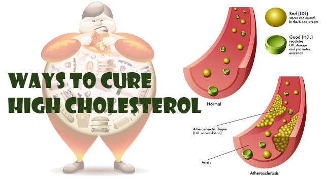 Reduce Risk High Cholesterol Natural Ways To Lower Cholesterol Levels